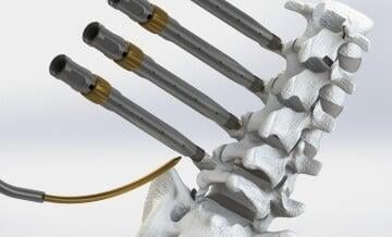 Spine Surgery Device